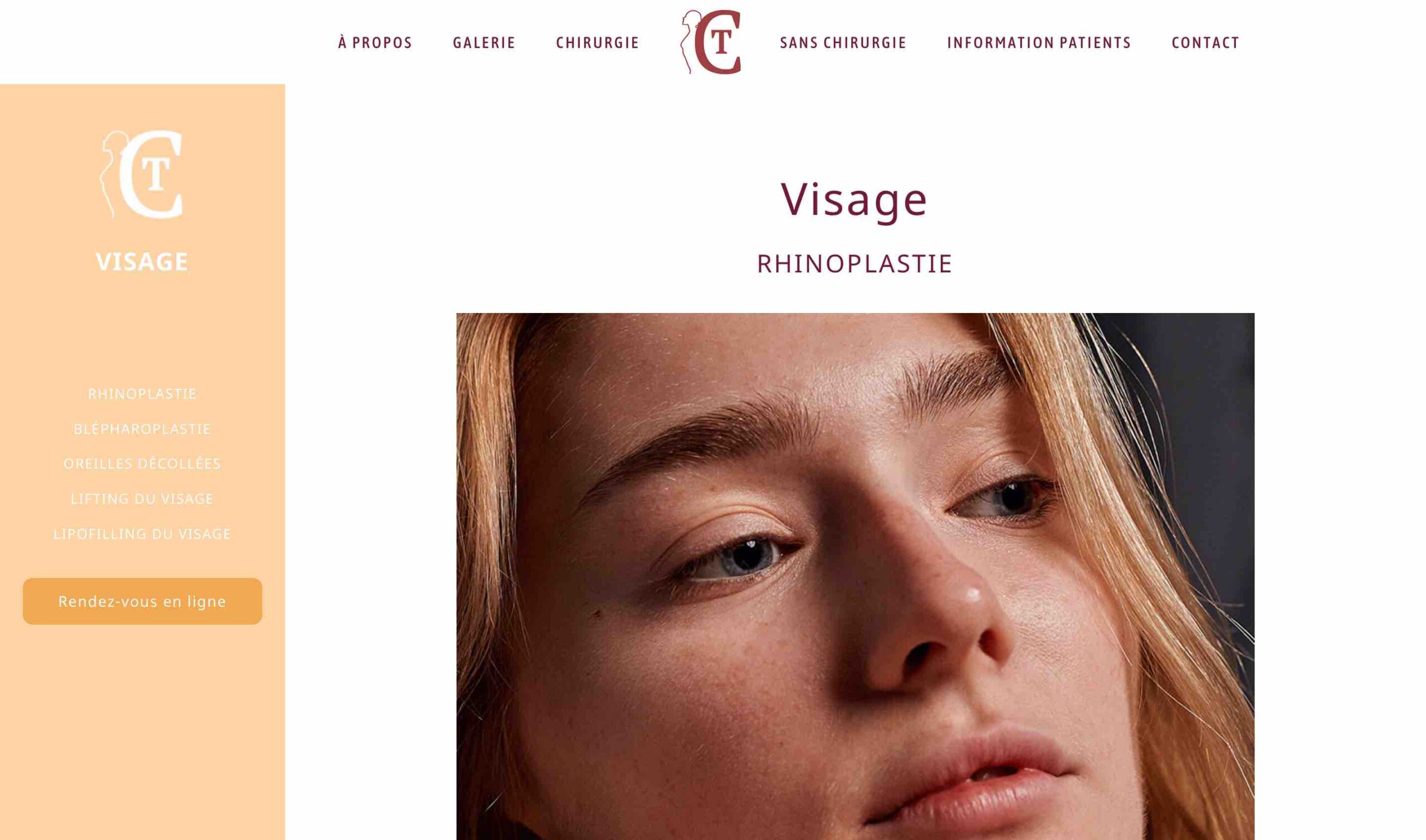 ANGELIQUE DAMOUR - projet DR COLSON - page chirurgie rhinoplastie